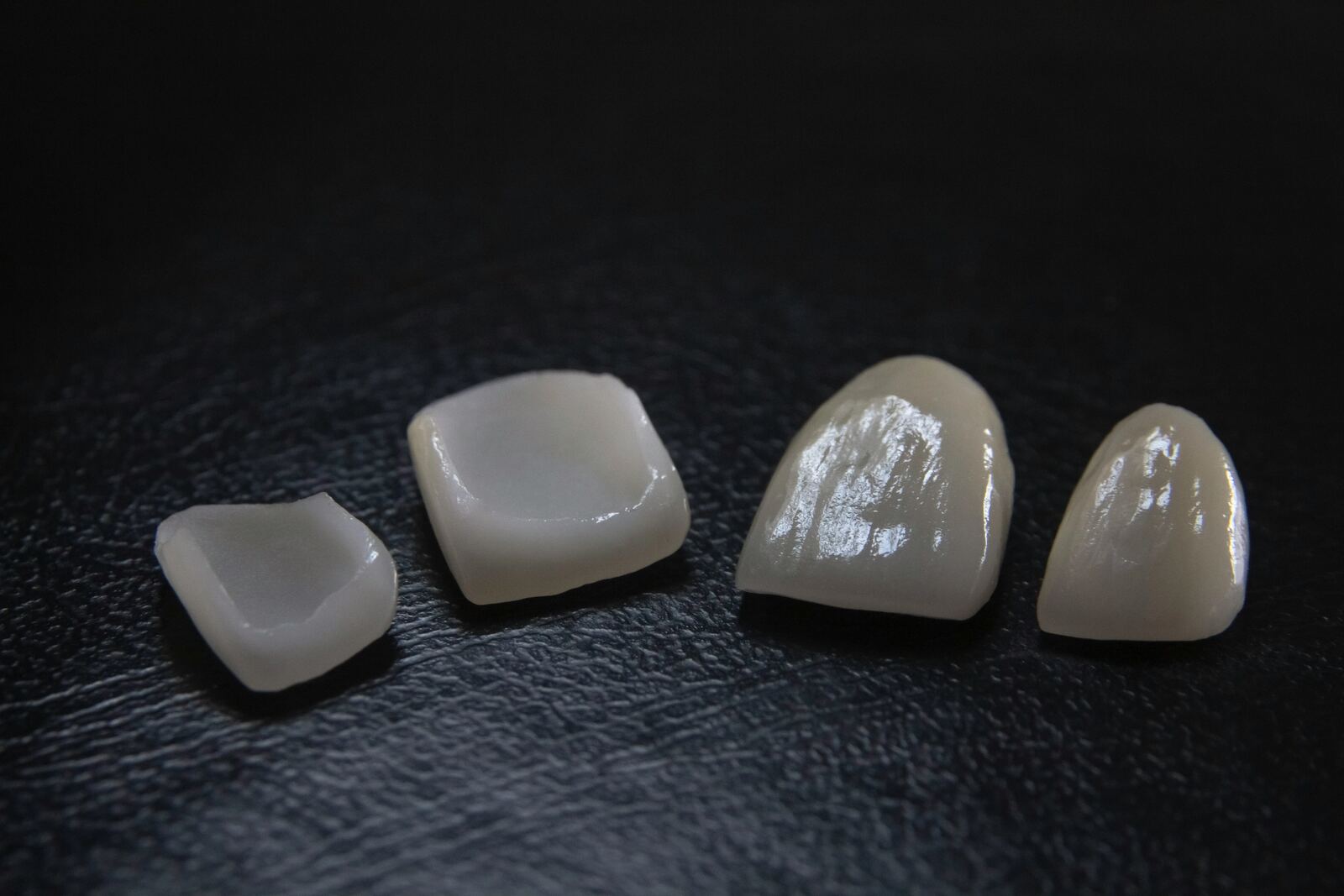 Dental restorations